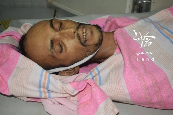 وفاة مختطف في سجون الحوثي جراء التعذيب بمحافظة تعز