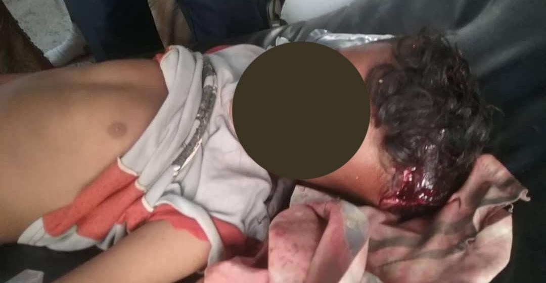 الحديدة.. مقتل طفل برصاص قناصة الحوثي بمديرية حيس