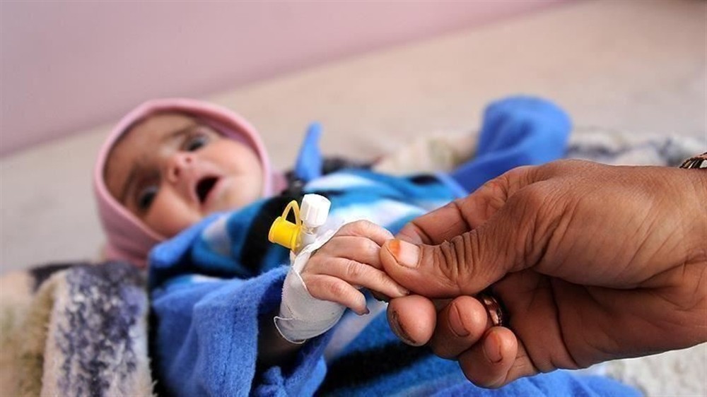 الصحة العالمية تعلن ثلاثة أرباع أطفال اليمن يعانون سوء التغذية