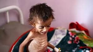 مخاوف أممية من مجاعة جديدة في اليمن بسبب نفص التمويل