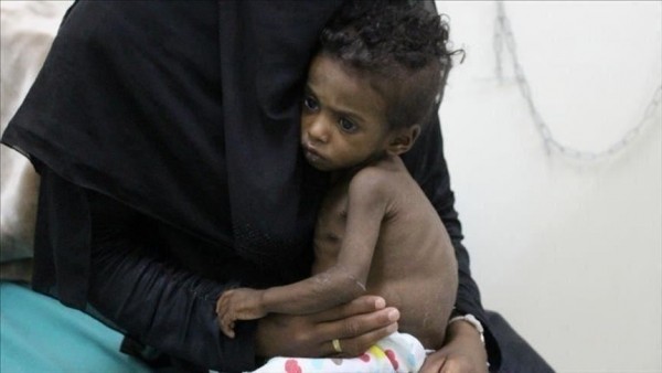 الأمم المتحدة: أكثر من نصف قتلى الصراع باليمن من النساء والأطفال