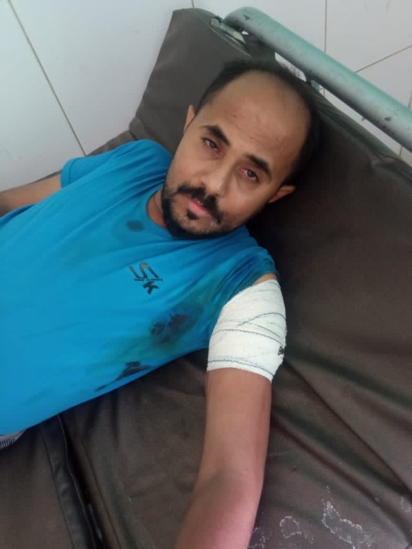 إصابة مواطن برصاص مليشيات الانتقالي غربي لحج