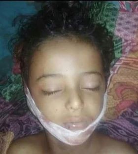 الضالع.. استشهاد طفل إثر إصابته برصاص قناصة المليشيات في قعطبة
