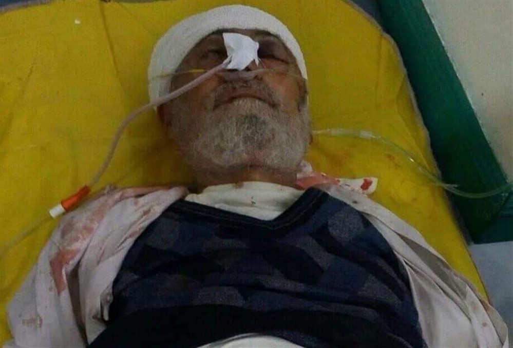 استشهاد مواطن متأثراً باصابته برصاص قناصة مليشيا الحوثي شرقي تعز