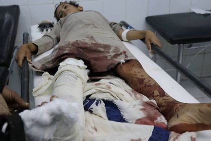 إصابة طفل بانفجار عبوة ناسفة في البيضاء