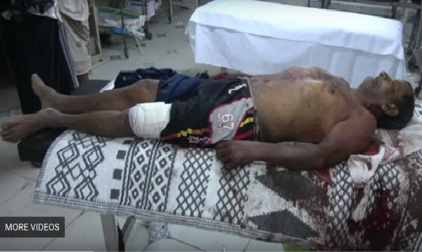 مقتل مواطن وإصابة آخر جراء قصف مليشيا الحوثي جنوب الحديدة