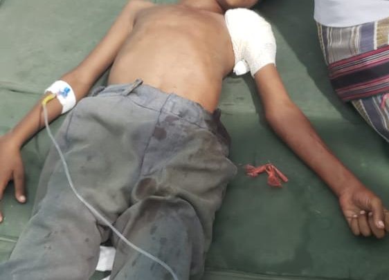 إصابة طفل برصاص مليشيا الحوثي في حيس بالحديدة