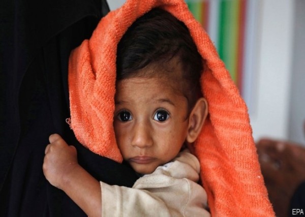 الأمم المتحدة تعلن.. الجوع وشح السيولة يدفعان عائلات يمنية الى أكل اوراق الشجر